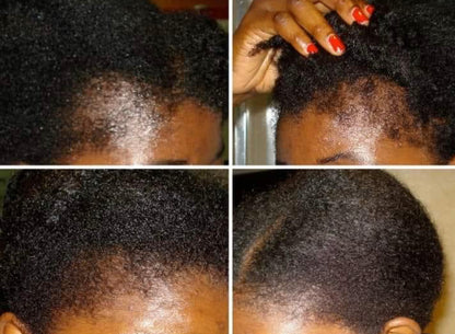 Rosemary +Fenugreek +Amla Thickening Hair Oil