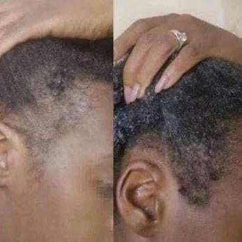 Rosemary Fenugreek Thickening Hair Oil/ Stimulating Hair Growth Oil