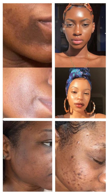 Turmeric Honey Carrot Scrub, Exfoliate Scrub, Hyperpigmentation Scrub, Foaming Scrub - Laaleeglow 
